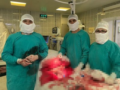 Хирург из Уфы рассказал, как оперировали 220-килограммового мужчину с опухолью