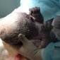 В Уфе врачи выходили новорожденного малыша с инфекцией