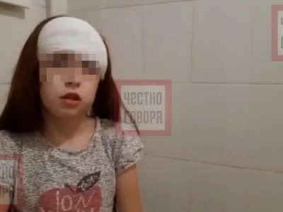 В Башкирии изувеченная собакой девочка рассказала о происшествии