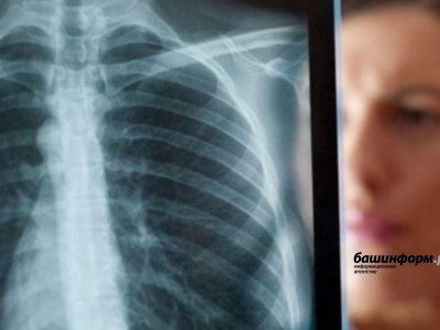 В Башкирии заболеваемость туберкулезом снизилась на 13,4% к прошлому году