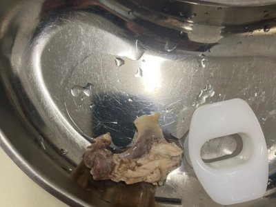 В Уфе врачи удалили застрявшую в пищеводе пациента кость курицы