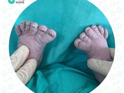 В Уфе женщина родила третьего ребенка с лишними пальчиками на ножках
