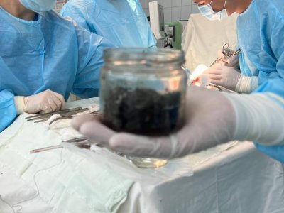 В Башкирии хирурги вынули из желудка пациента 300 граммов магнитных частиц