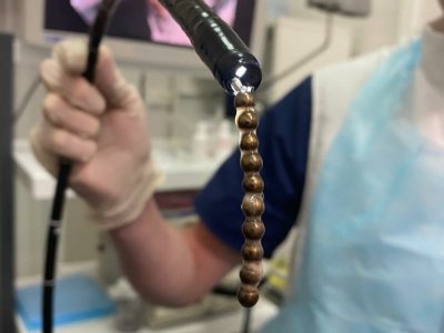 В Уфе врачи спасли ребенка, проглотившего сразу 10 магнитных шариков