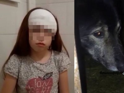 В Уфе после нападения собаки у девочки остались шрамы и покалеченная психика, у хозяйки пса - штраф